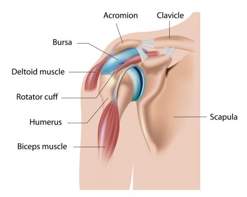 Cuanto dura la recuperacion de tendinitis de hombro Cuanto dura la recuperacion de tendinitis de hombro